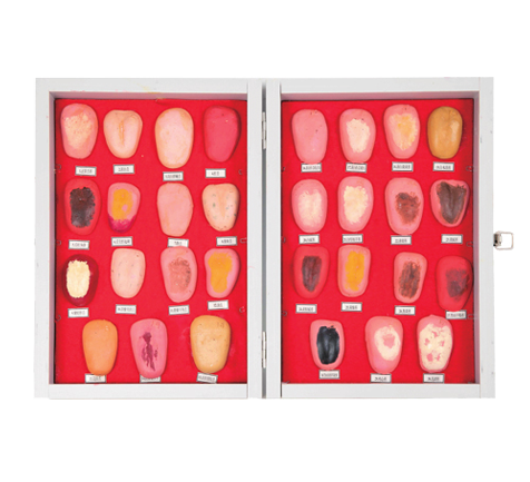 舌苔模型（石蜡）